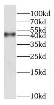 NDRG2 Rabbit Polyclonal Antibody
