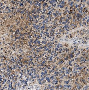 NDRG4 Rabbit Polyclonal Antibody