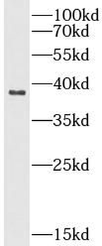 NDUFA9 Rabbit Polyclonal Antibody