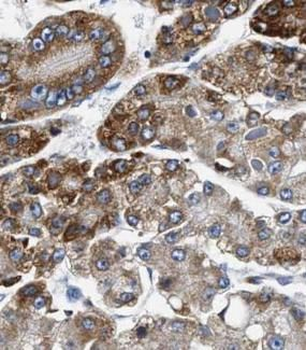 NDUFA9 Rabbit Polyclonal Antibody