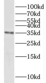 NDUFAF1 Rabbit Polyclonal Antibody