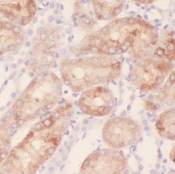 NDUFAF1 Rabbit Polyclonal Antibody