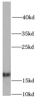 NDUFB5 Rabbit Polyclonal Antibody