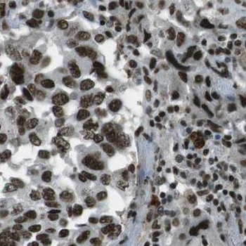 NDUFB5 Rabbit Polyclonal Antibody