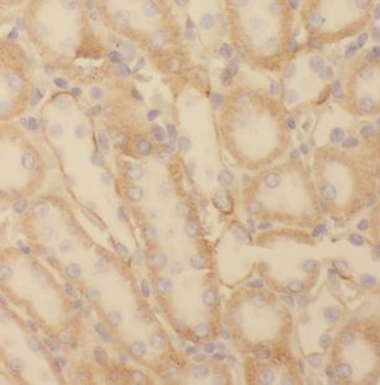 NDUFC2 Rabbit Polyclonal Antibody