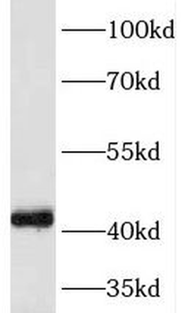 NECAB3 Rabbit Polyclonal Antibody