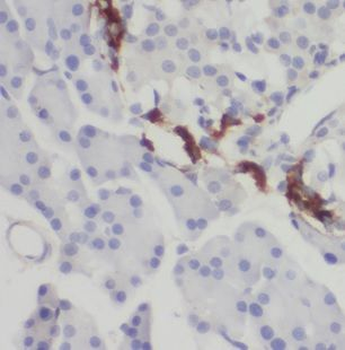 NECAB3 Rabbit Polyclonal Antibody