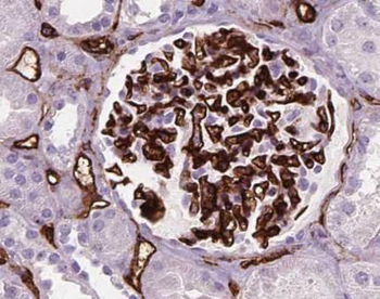 NECTIN2 Rabbit Polyclonal Antibody