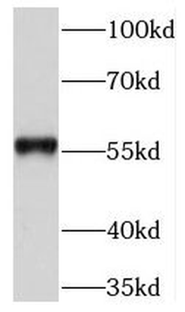 NEK3 Rabbit Polyclonal Antibody