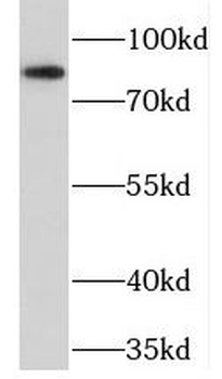NELL1 Rabbit Polyclonal Antibody