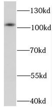 NELL2 Rabbit Polyclonal Antibody