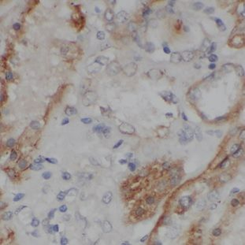 NELL2 Rabbit Polyclonal Antibody
