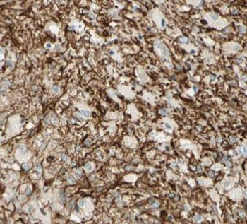 NES Mouse Monoclonal Antibody