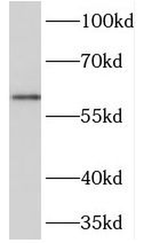NETO2 Rabbit Polyclonal Antibody