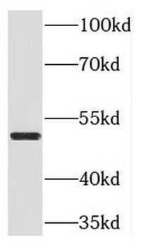 NEUROD1 Rabbit Polyclonal Antibody