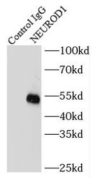 NEUROD1 Rabbit Polyclonal Antibody
