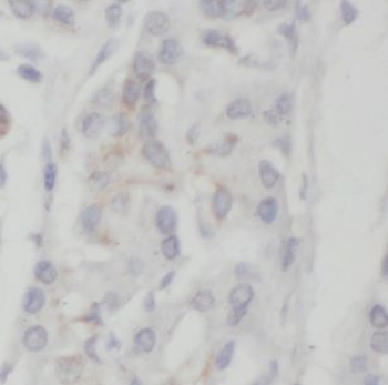 NEUROD1 Rabbit Polyclonal Antibody