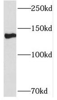 NFATC2 Rabbit Polyclonal Antibody
