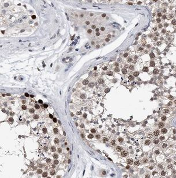NFATC2 Rabbit Polyclonal Antibody