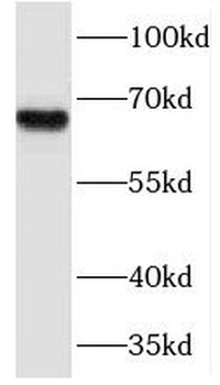 NFE2L1 Rabbit Polyclonal Antibody