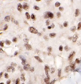 NFE2L1 Rabbit Polyclonal Antibody