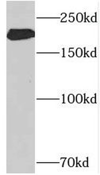 NEFH Rabbit Polyclonal Antibody