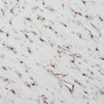 NEFH Rabbit Polyclonal Antibody
