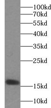 NGB Rabbit Polyclonal Antibody