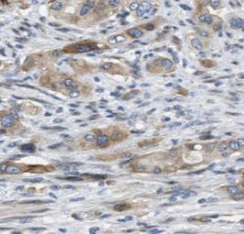 NGB Rabbit Polyclonal Antibody