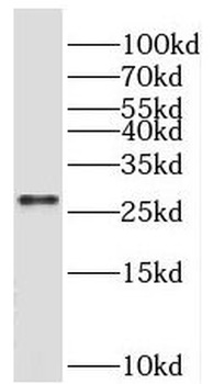 BEX3 Rabbit Polyclonal Antibody