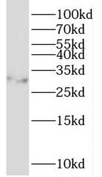 NKX2 2 Rabbit Polyclonal Antibody