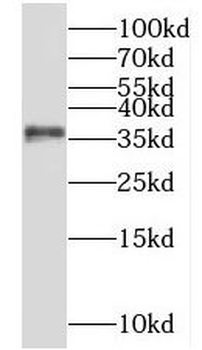 NKX3 1 Rabbit Polyclonal Antibody