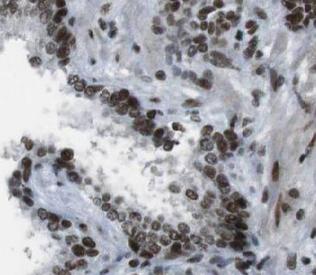 NKX3 1 Rabbit Polyclonal Antibody