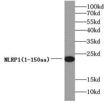 NLRP1 Rabbit Polyclonal Antibody