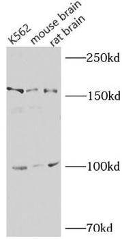 NLRP1 Rabbit Polyclonal Antibody