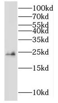 NME5 Rabbit Polyclonal Antibody