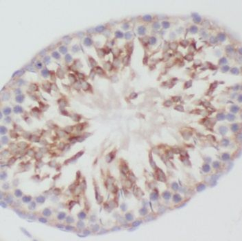NME5 Rabbit Polyclonal Antibody