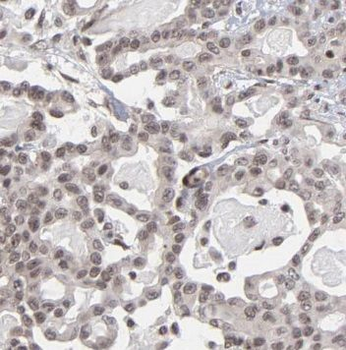 NMNAT1 Rabbit Polyclonal Antibody