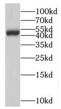 NMUR1 Rabbit Polyclonal Antibody