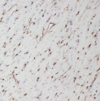 NMUR1 Rabbit Polyclonal Antibody