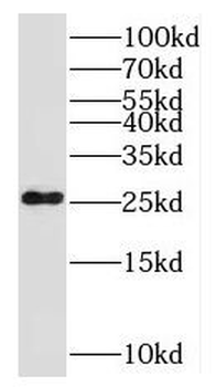 NOG Rabbit Polyclonal Antibody