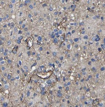 NOG Rabbit Polyclonal Antibody