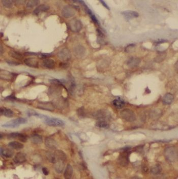 NOL3 Rabbit Polyclonal Antibody