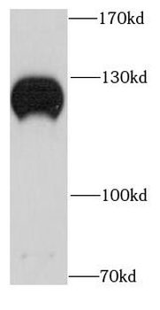 NOLC1 Rabbit Polyclonal Antibody