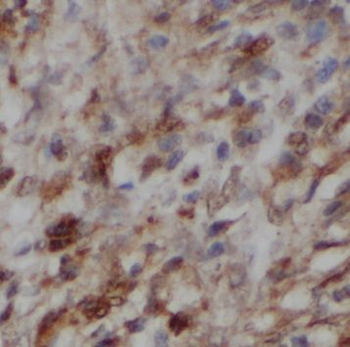 NOLC1 Rabbit Polyclonal Antibody