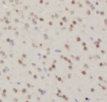 NOTCH1 Rabbit Polyclonal Antibody