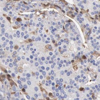 CCN3 Rabbit Polyclonal Antibody