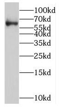 NOVA2 Rabbit Polyclonal Antibody
