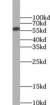 NOX4 Rabbit Polyclonal Antibody