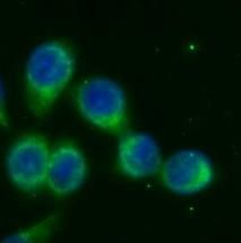 NOX4 Rabbit Polyclonal Antibody